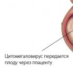 Citomegalovirus lgg en mujeres embarazadas 1251