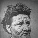“Enfermedad fenicia. ¿Quién es el leproso? Sobre la historia de la enfermedad de la lepra, ¿cuál de las personas famosas la padeció?